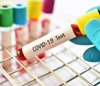 Gürcüstanda koronavirusa 407 yeni yoluxma qeydə alınıb